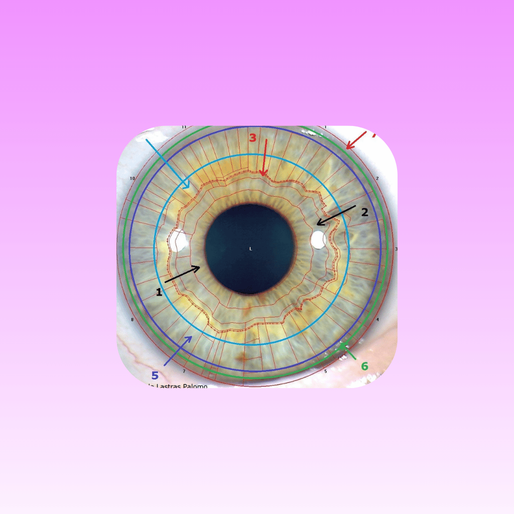 IRIDIOLOGIA